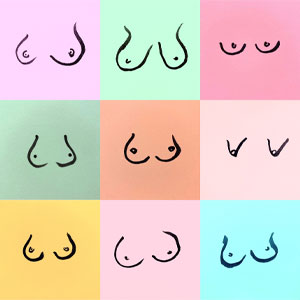 Difference in shape or size of a breast