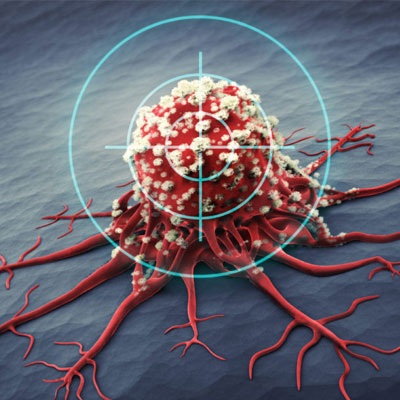 Targeted therapy